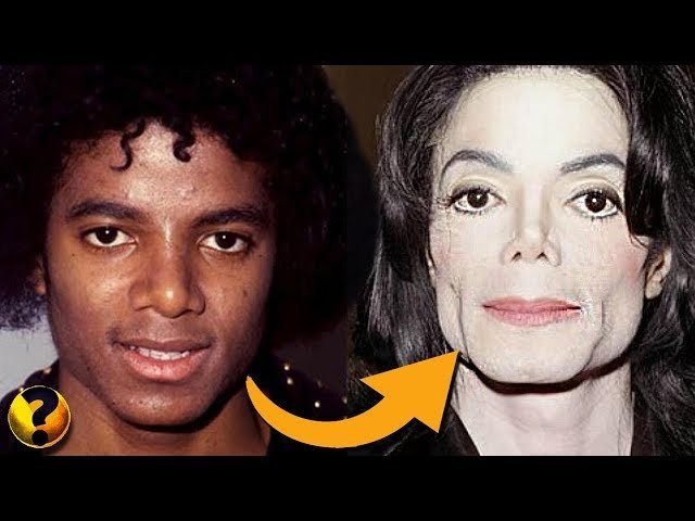 Como Michael Jackson Mudou de Cor e Quais Foram as Causas